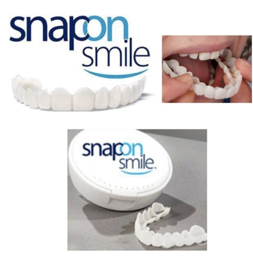Snap-On Dentures