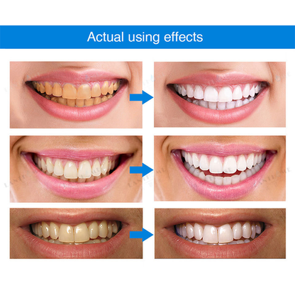 🔥Teeth Whitening Essence