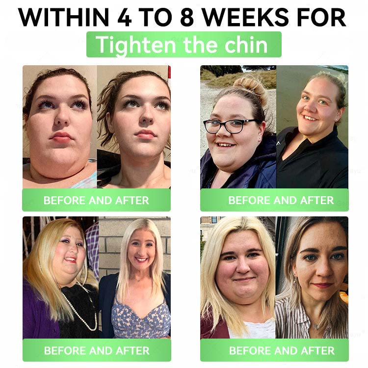 🔥Moringa × Berberine × AMPK 8-Benefit Slimming & Metabolic Nano Microneedle Patch 🇺🇸  Just once a day · Visible changes in 7 days  ✅ For obesity, loose skin, diabetes, sleep apnea, joint issues, and more